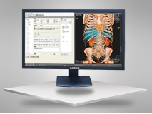 LOCUS專業醫用液晶系列顯示器