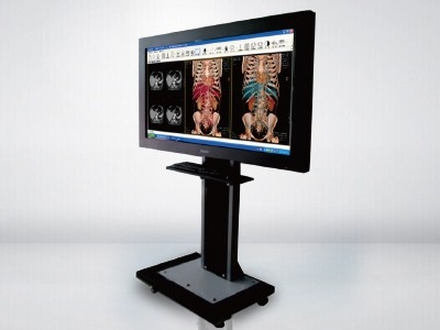LOCUS 觸摸屏式醫學影像會診讀片系統